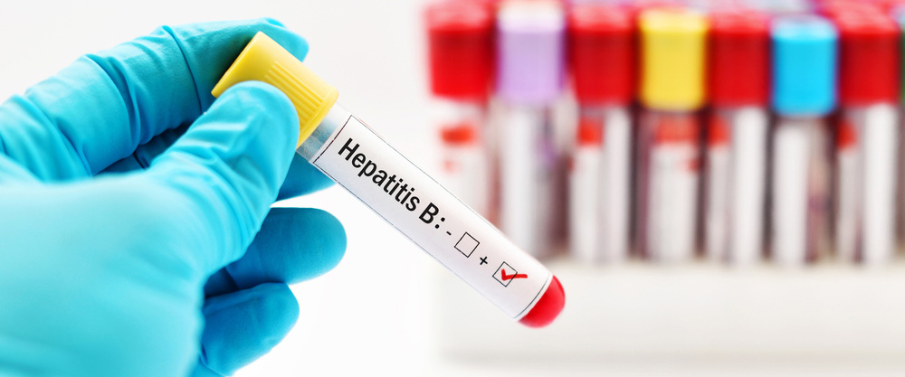 Mi az a hepatitis B? Mik a tünetek és a kezelési módszerek?